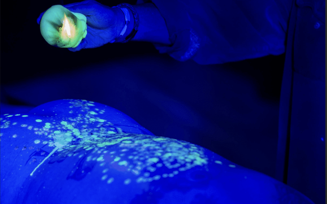 Turning up the heat: exploring the unexpected pleasures of hot wax play