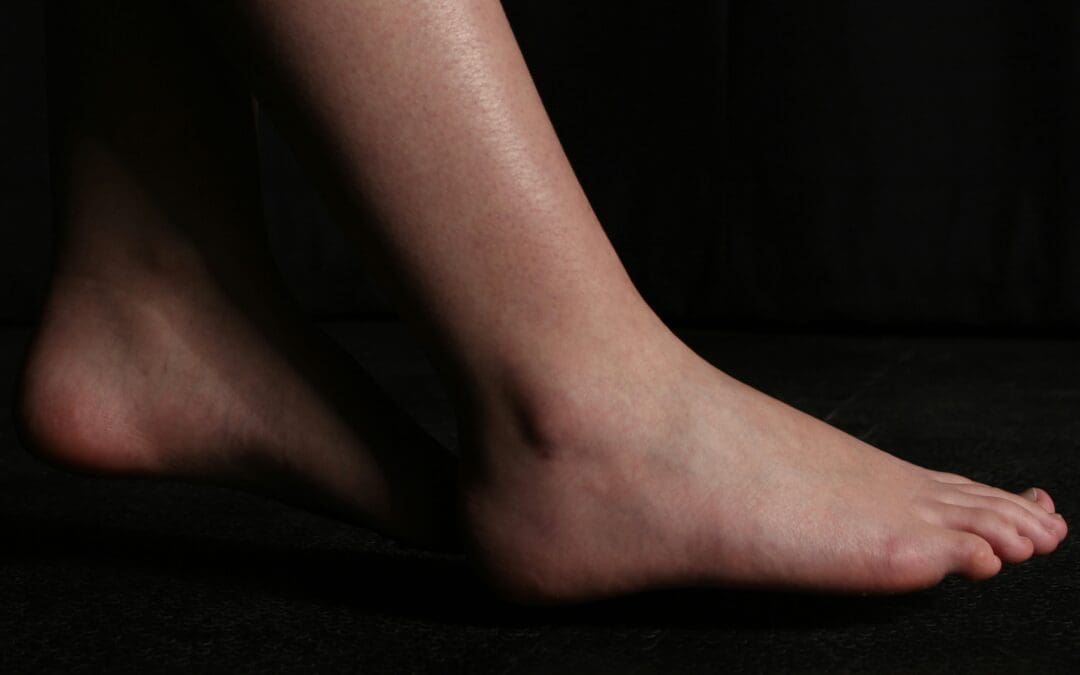 The business behind the foot shot
